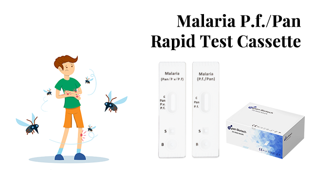 Malaria P.f./Pan Rapid Test Cassette (Whole Blood): A Breakthrough in Malaria Diagnosis