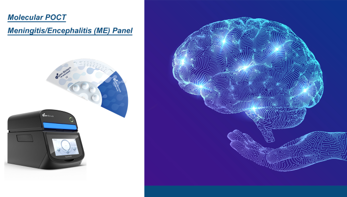 MeningitisEncephalitis Panel, Real-Time PCR(1).png