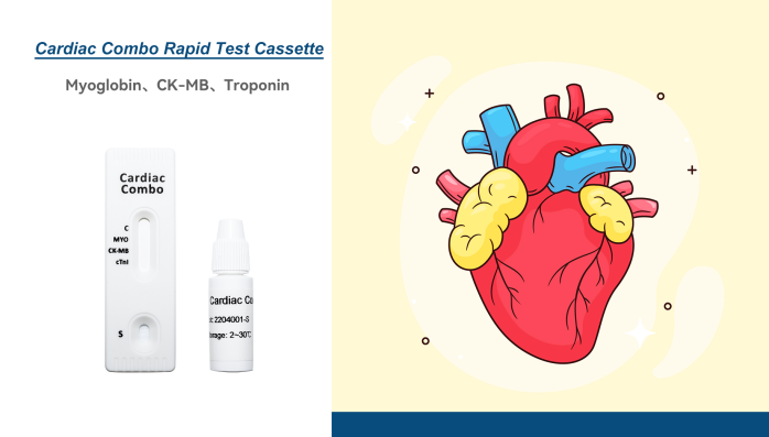 For AMI Differential Diagnosis: Myoglobin/CK-MB/Troponin I Combo Rapid Test Cassette